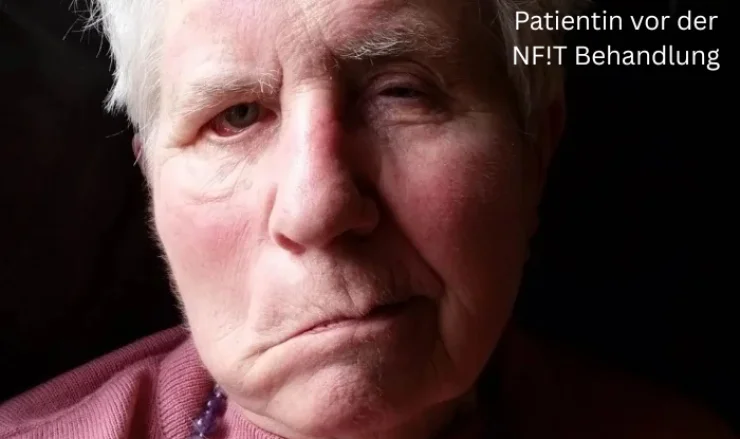 Patientin vor der NF!T Behandlung Patientin vor der NF!T Behandlung